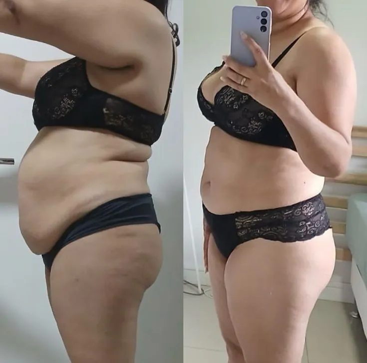 Antes e depois